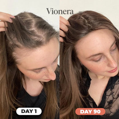 Vionera™ Pumpkin Seed Oil Softgels