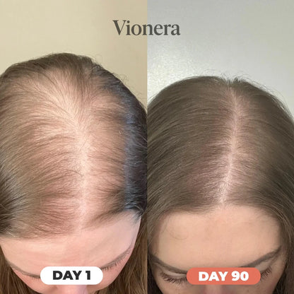 Vionera™ Pumpkin Seed Oil Softgels